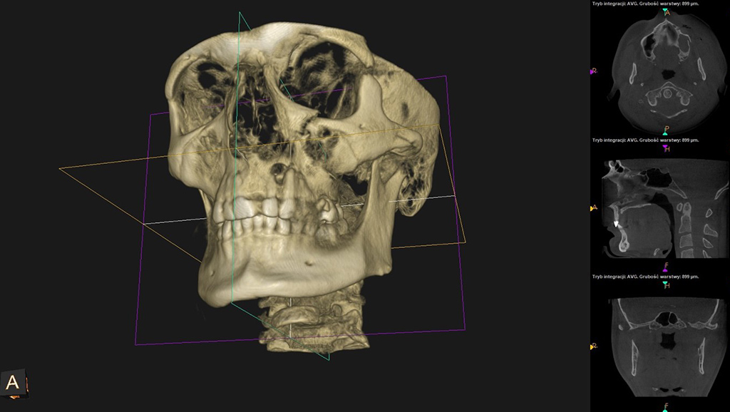 diagnostyka leczenie schorzen czaszki twarzowej